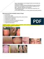 Casos Clinicos Dermatologia