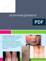 Атопічний дерматит