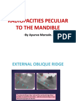 Radiopacities Peculiar to the Mandible
