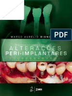 Implanto25 - Diagnóstico e Tratamento Das Alterações Peri-Implantares - Bianchini