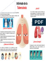 Cartelera Tuberculosis