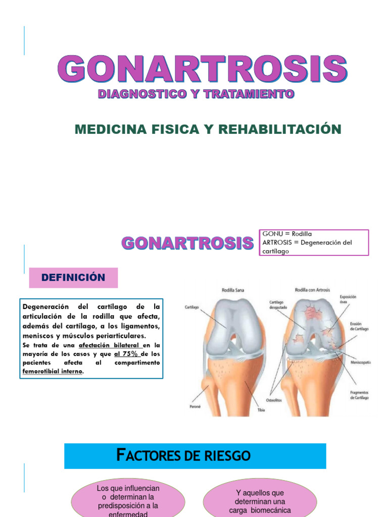 Tratamiento y Diagnóstico de Gonartrosis | PDF | Rodilla | Articulación