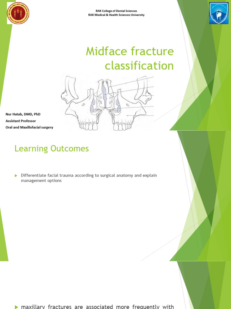Midface fracture classification, signs, symptoms, radiographic presentation and different