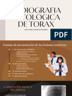 Radiografia Patologica de Torax JAER