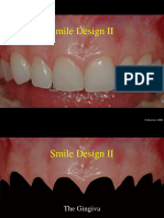 Smile Design 5