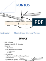 Puntos de Sutura