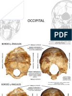 Occipital y Etmoides