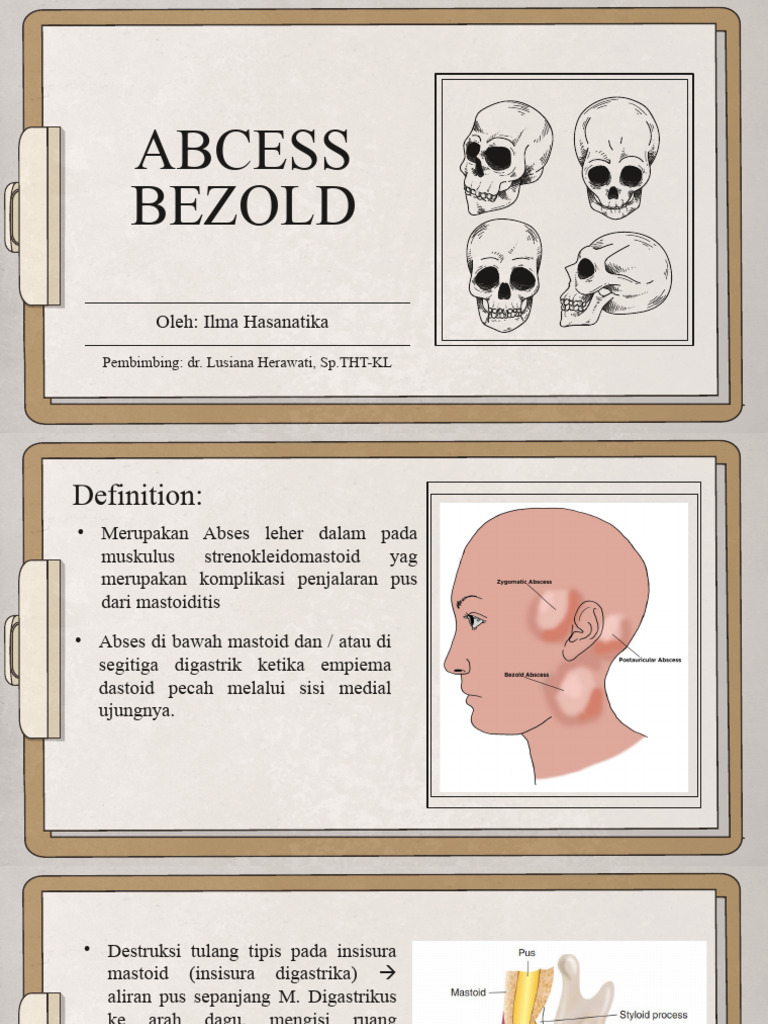 Abses Bezold PDF