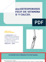 Caso Clínico Osteoporosis Por Def. Vit D y Cal. CARLOS