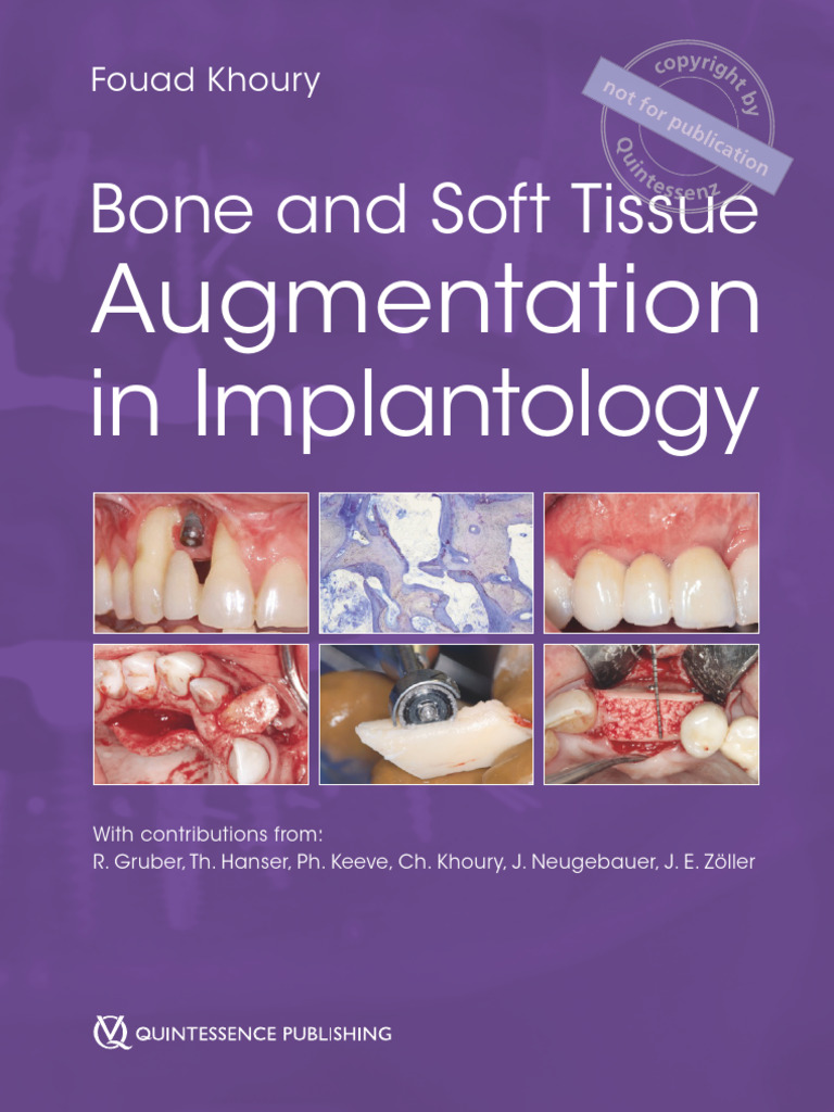 Leseprobe 14891 Khoury Bone and Soft Tissue | PDF | Dental Implant ...