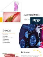 Ateroesclerosis