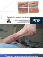 Úlceras de Extremidad Inferior (UEI)