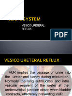 Vesico Ureteral Reflux