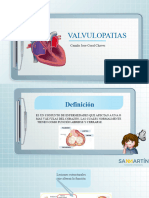 Valvulopatias1
