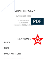 Making Ecg'S Easy: Evaluating The Ecg DR Nick Robinson 01206 504320