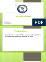COLEDOCOLITIASIS