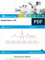 Module Name - ECG