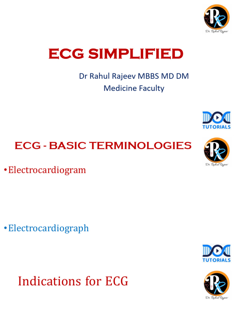 ECG Simplified: Key Concepts and Analysis | PDF