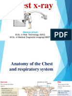 Chest X-Ray