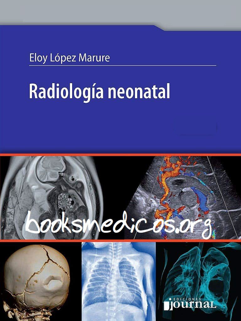 Radiologia Neonatal | PDF | Especialidades Medicas | Medicina CLINICA, image size:768x1024