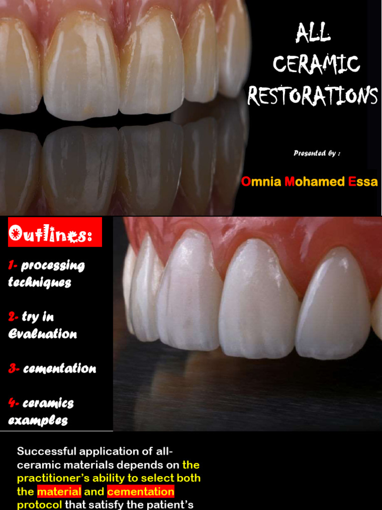 7-All-Ceramics Try in & Cementation | PDF | Ceramics | Dentistry Branches