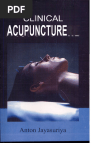Jayasuriya A. Clinical Acupuncture 2000