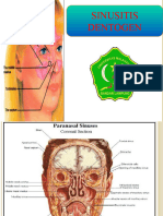 THT Sinusitis