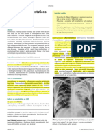 Chest X-ray manifestations of pneumonia