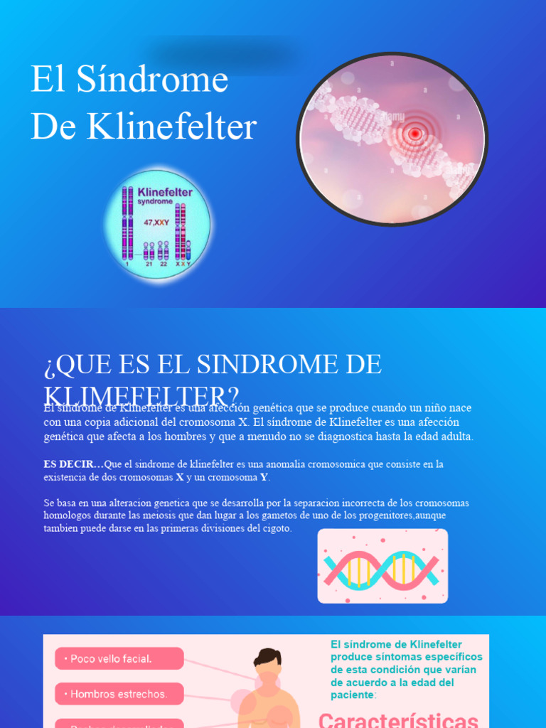 Sindrome de Klinefelter | PDF