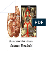 Cerebrovascular Stroke