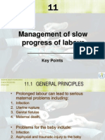 Management of Slow Progress of Labour