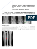 Fracture 05-05-2023