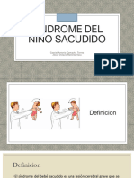 Sindrome Del Niño Sacudido