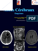 PR - NEAU Abces Cerebraux