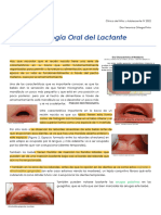 Patología Oral en El Lactante