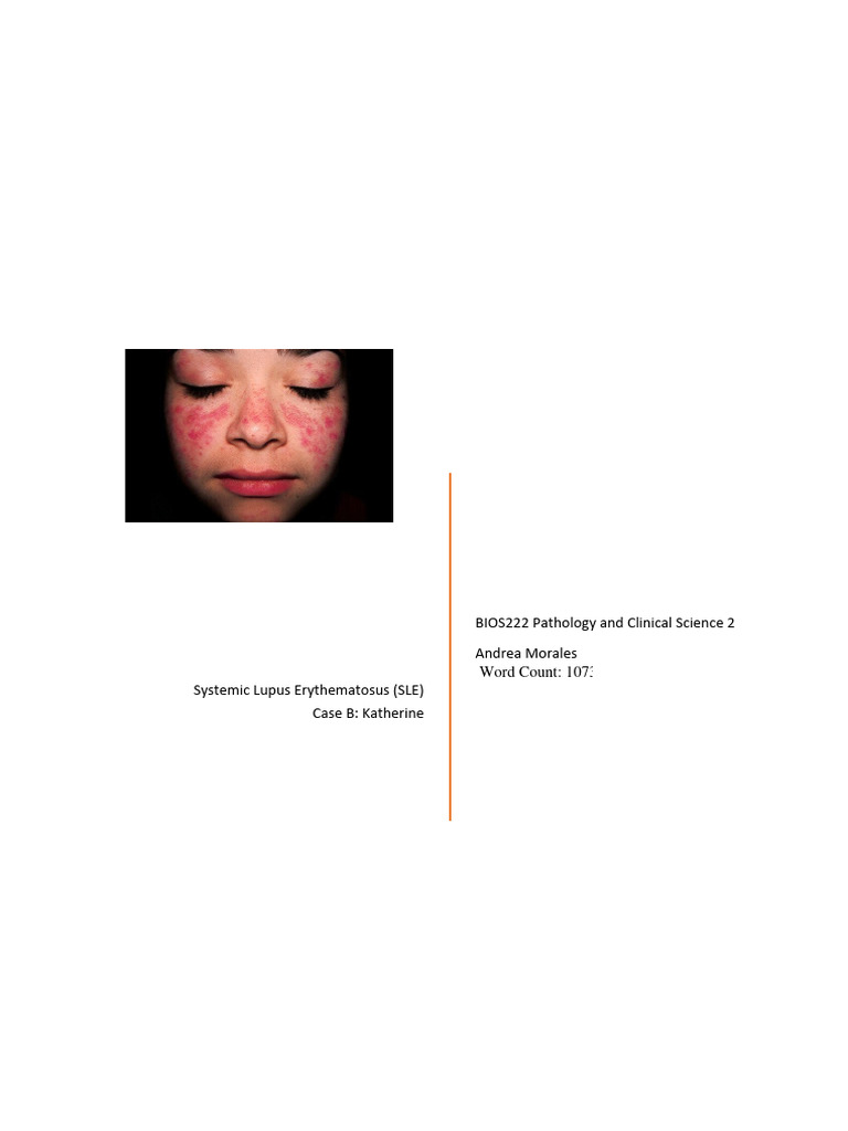 Pathophysiology Of Lupus Erythematosus Pdf Free Download