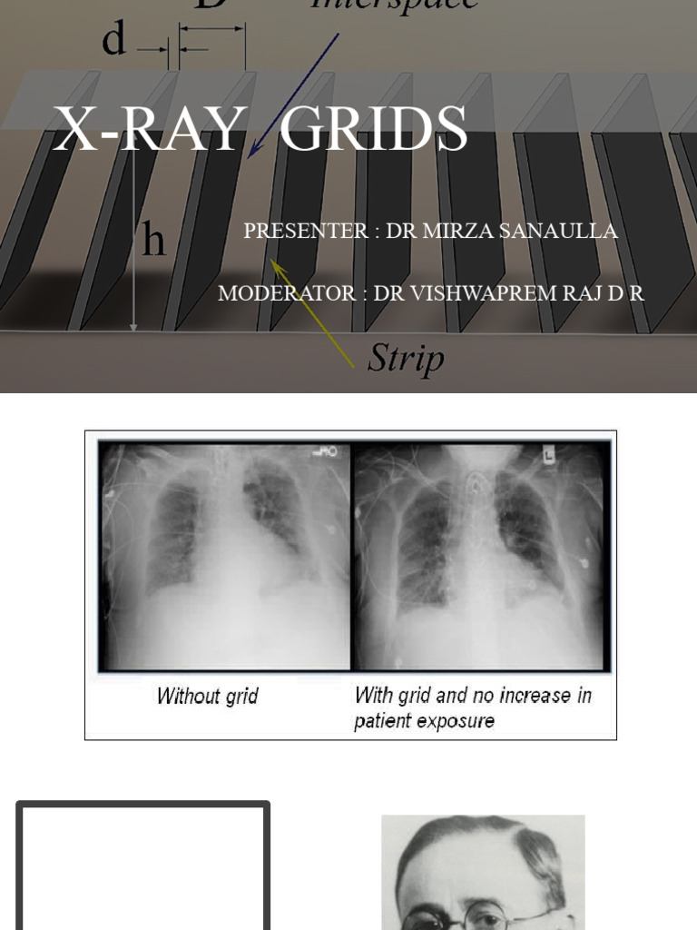 Grids | Download Free PDF | Radiography | X Ray