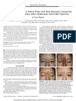 Ischemic Oculomotor Nerve Palsy and Skin Necrosis Caused by Vascular Embolization After Hyaluronic Acid Filler Injection - A Case Report