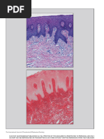 Tuberosidad Histologia