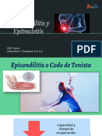 Epicondilitis