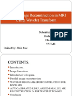 Parallel Image Reconstruction in MRI Using Wavelet Transform