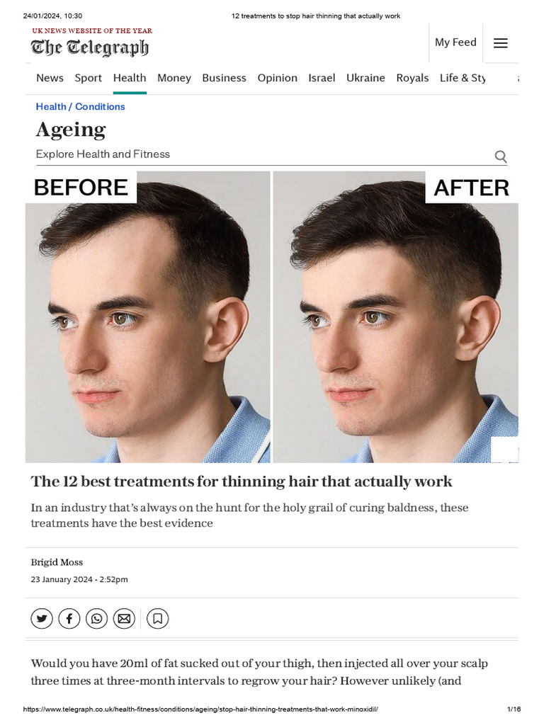 12-treatments-to-stop-hair-thinning-that-actually-work-download-free