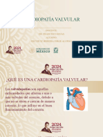Valvulopatias2 0