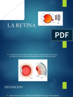 La Retina