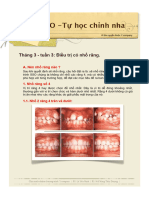 33 Điều Trị Có Nhổ Răng.