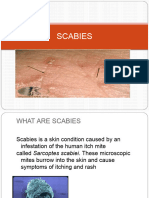 Scabies