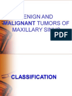 Benign and Malignant Tumors of Maxillary Sinus - Ashish