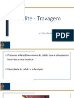 Aula 7 - Palatite J Aerofagia e Obstrução Esofagica