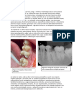 Caso Clinico Estomato