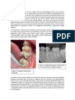 Caso Clinico 01